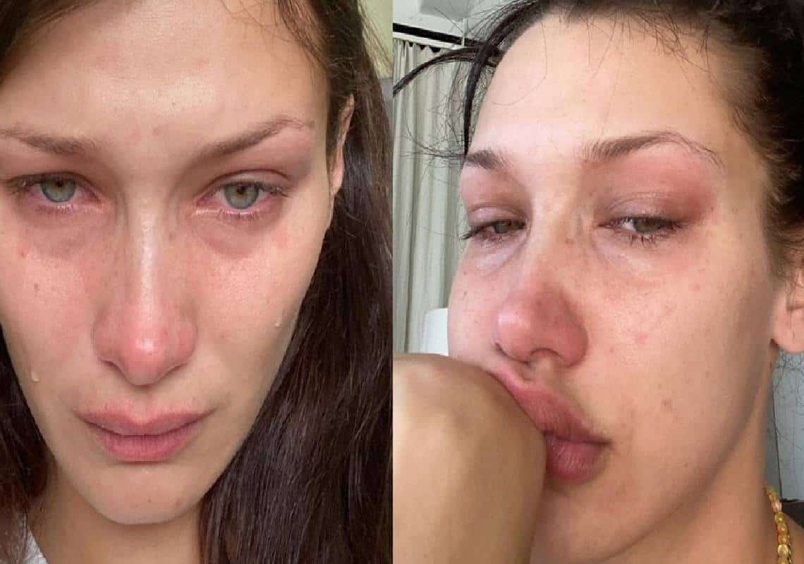 בלה חדיד מדברת על הקושי הנפשי איתו היא מתמודדת: ״אני בוכה כל יום וכל לילה״
