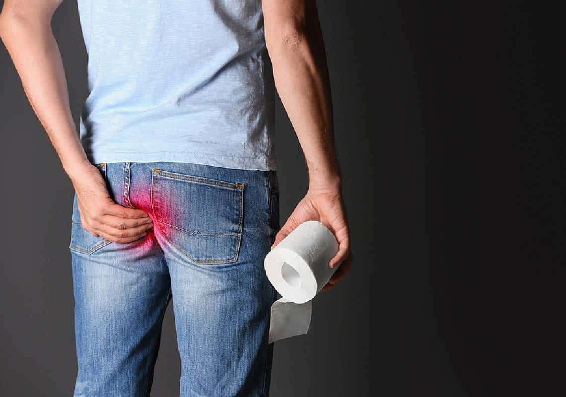 סובלים מטחורים? הנה כמה שיטות טבעיות שיכולות לעזור לכם