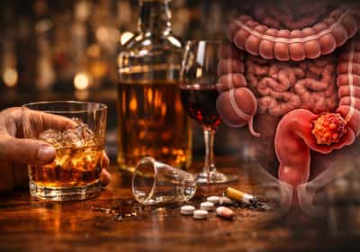 כמה אתם שותים בשבוע? מחקר אמריקאי קושר בין שתייה כבדה לסרטן המעי הגס והרקטום