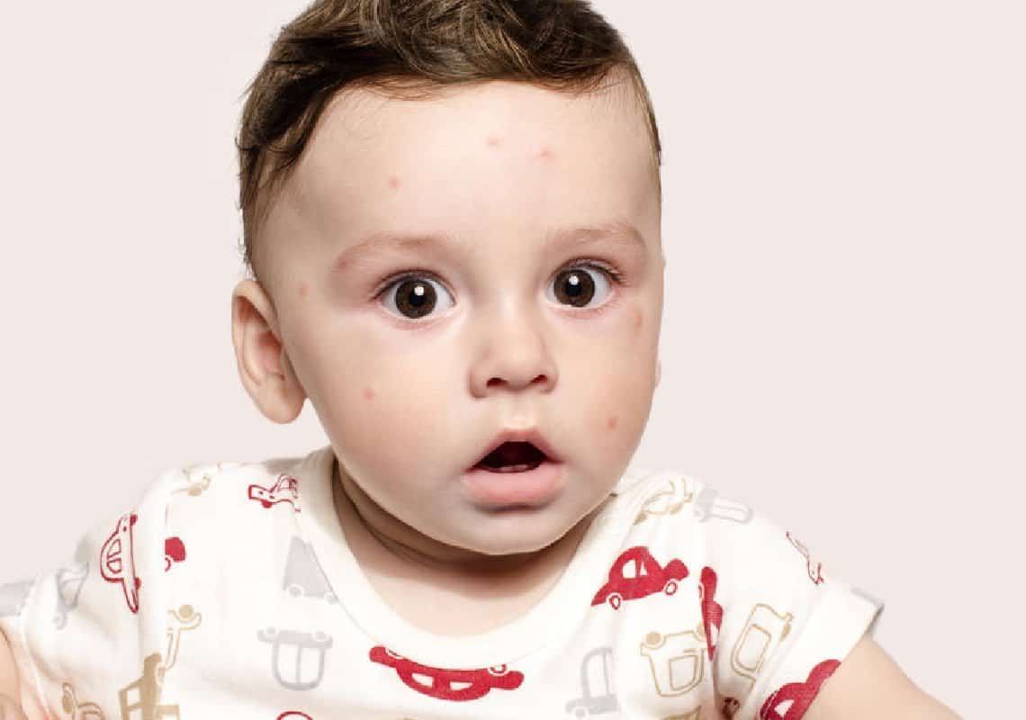 התופעה השכיחה בקרב תינוקות וילדים שחשוב להכיר 