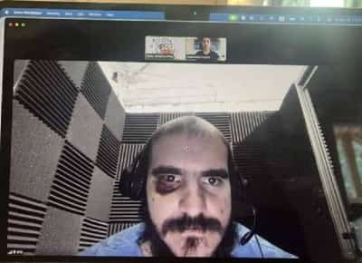 מאחורי הגדרות של "אליגייטור אלקטרז": בית משפט פדרלי שומע על עינויים, התעללות וחוסר רחמים