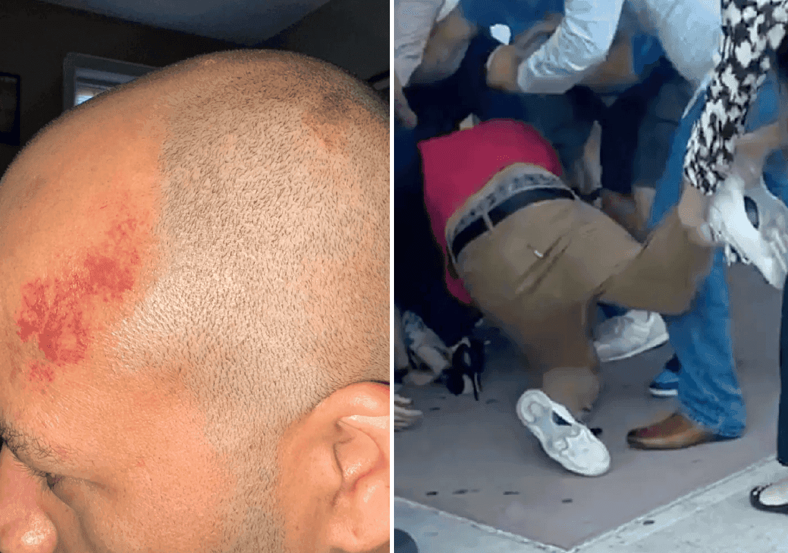 טקס הסיום שהפך לאלים: משפחה יהודית הותקפה פיזית על ידי משפחה פרו-פלסטינית 