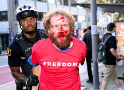 אלימות קשה בברקלי: עימותים קשים בין מפגינים לשמרנים – והמאבק על חופש הביטוי בקמפוסים מתלהט