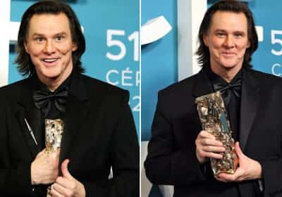 מה קרה לפנים של ג'ים קארי?