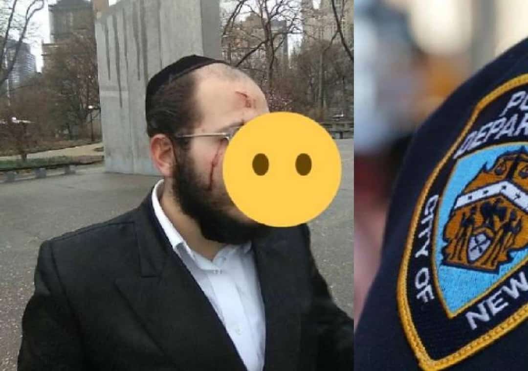 פשע שנאה בחול המועד: משוחרר בערבות על ניסיון-רצח חתך בסכין את פרצופה של משפחה יהודית בלב מנהטן