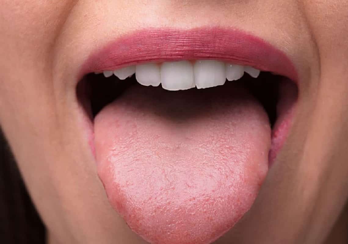 הפה מתייבש? מדוע זה קורה, ומה עושים: כל מה שכדאי לדעת 